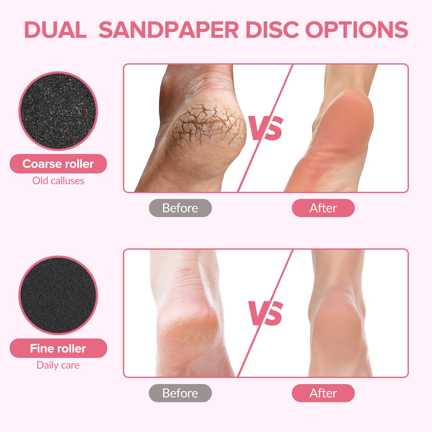 Electric Foot Callus Remover, Pain-Free Electric Foot File with 60pcs Sanding Discs, Adjustable Speed, Gentle and Not Hurt Feet (Black)