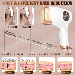Yoovee IPL Device - Laser Treatment for Men & Women at Home. 999,999 Flashes, FDA Approved, Perfect for Face, Legs, Arms & Bikini Line